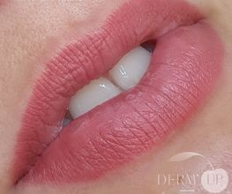 DERM UP image 1
