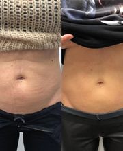 Future Beauty by Troxler Bild 10