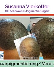 Microhaar Verdichtung 24