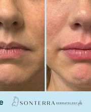 Sonterra Dermatology image 17