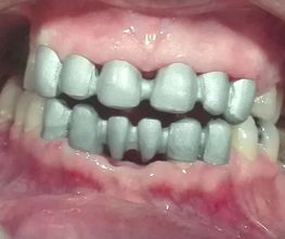 Clínica Dental Quart imagen 9