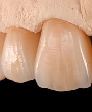 Palm Zahntechnik Inh. Sebastian Palm Bild 1