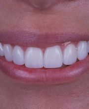 Calaway Dental image 17