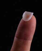 Lente de Contato Dental, Dr. Marcelo Borille imagen 2