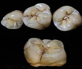 implante-dental-09-g.jpg