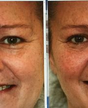 Brad Pitts Family & Cosmetic Dentistry image 7