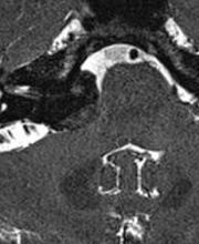 Prof. Dr. med. Merlo Adrian Bild 3