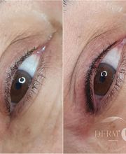 DERM UP image 4