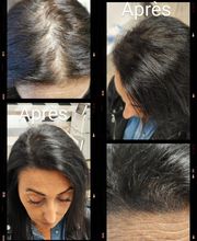 L'institut Capillaire image 15