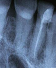 Zahnarzt Orpund AG Bild 4