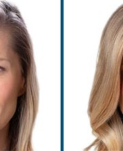 Lift Aesthetics image 12