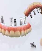 Dentallabor Christian Stroehl Bild 2