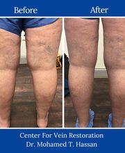Center for Vein Restoration | Dr. Mohamed Hassan image 13