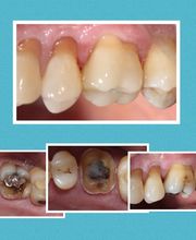 Green Valley Dental Center image 5