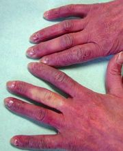 Consulta Barreiro-Vascular (Drs. A. Barreiro Mouro y J. Barreiro Veiguela) imagen 11