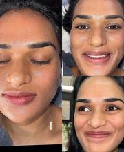 Grace Medspa & Body Solutions image 4