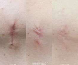 Sara-pavo.cosmetics-Narbe-essen.jpg