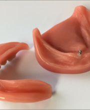 Hengartner Jürg, Zahnprothetik Bild 2