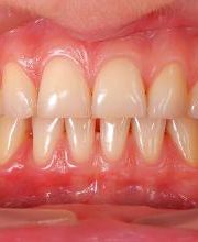 Clínica Dental Santa Eulàlia imagen 13