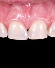 Clínica Dental Dres. Nuñez García imagen 3