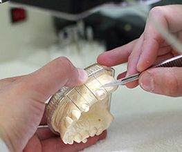 dental-sirera-protesis-01.jpg