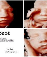 See Baby Ecografía Emocional imagen 20