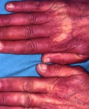 Consulta Barreiro-Vascular (Drs. A. Barreiro Mouro y J. Barreiro Veiguela) imagen 12