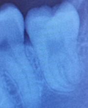 Zahnarzt Dr. med. dent. Franck R. Tolen Bild 8