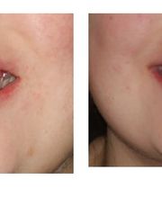 Aspen Ridge Dental image 9