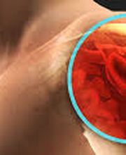 FISIO ANTYSTIFF Bild 4