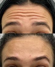 Juvenalia Brío | Botox, Hydrafacial & Ultraformer - Condesa / Roma Norte CDMX imagen 12