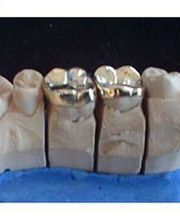 Dentalstudio Peter Häupler e.K. Bild 2