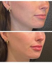 Truly Lifted MedSpa image 8