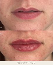 Skintonomy Medical Spa image 18