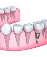 Periodontics, P.C. image 6