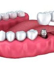 Clínica Dental Vitaldent imagen 10