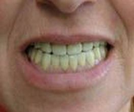 Clínica Implanteoral Milladoiro imagen 12