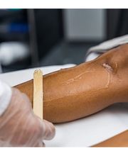 infinity Haarentfernung Bild 4