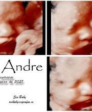 See Baby Ecografía Emocional imagen 13