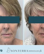 Sonterra Dermatology image 13
