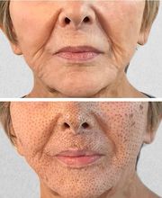 Wrinkle Free WA image 3