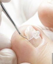 PodoAkitve Berlin Bild 15