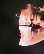 Heartland Endodontics image 18