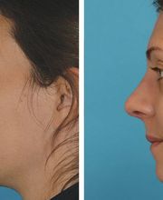 Eugenie Brunner, MD, FACS image 10