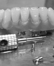 Laboratorio Dental J C imagen 3