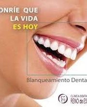 foto-blanquamientodental.jpg