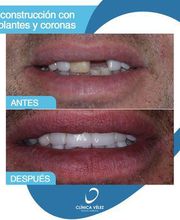 Clinica-demtal-y-Estetica-Velez-7.jpeg