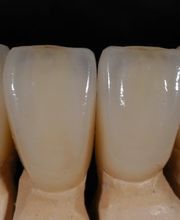 Müller Dental-Technology Bild 5