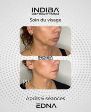 Reserve Ton Soin Institut de Beauté image 2