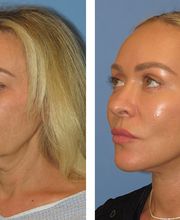 Stephen Bresnick MD image 1